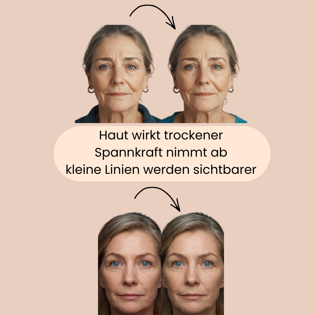 2 Frauen wo man sieht, dass ihre Haut trockener wirkt, die Spannkraft abnimmt und kleine Linien sichtbarer werden. 